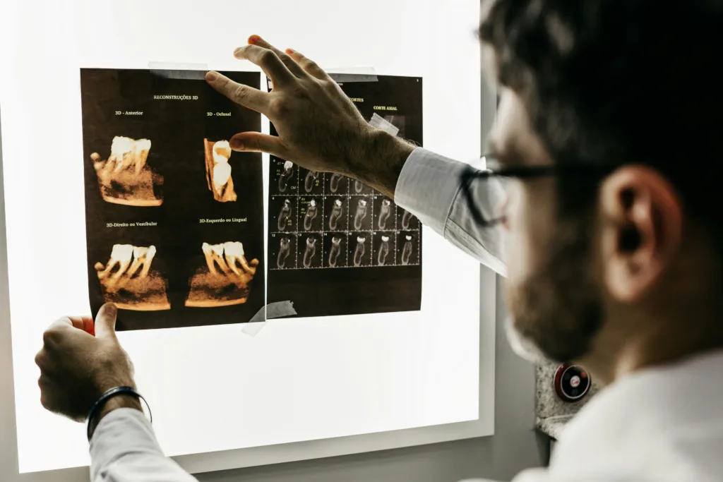 A person looking at an xray