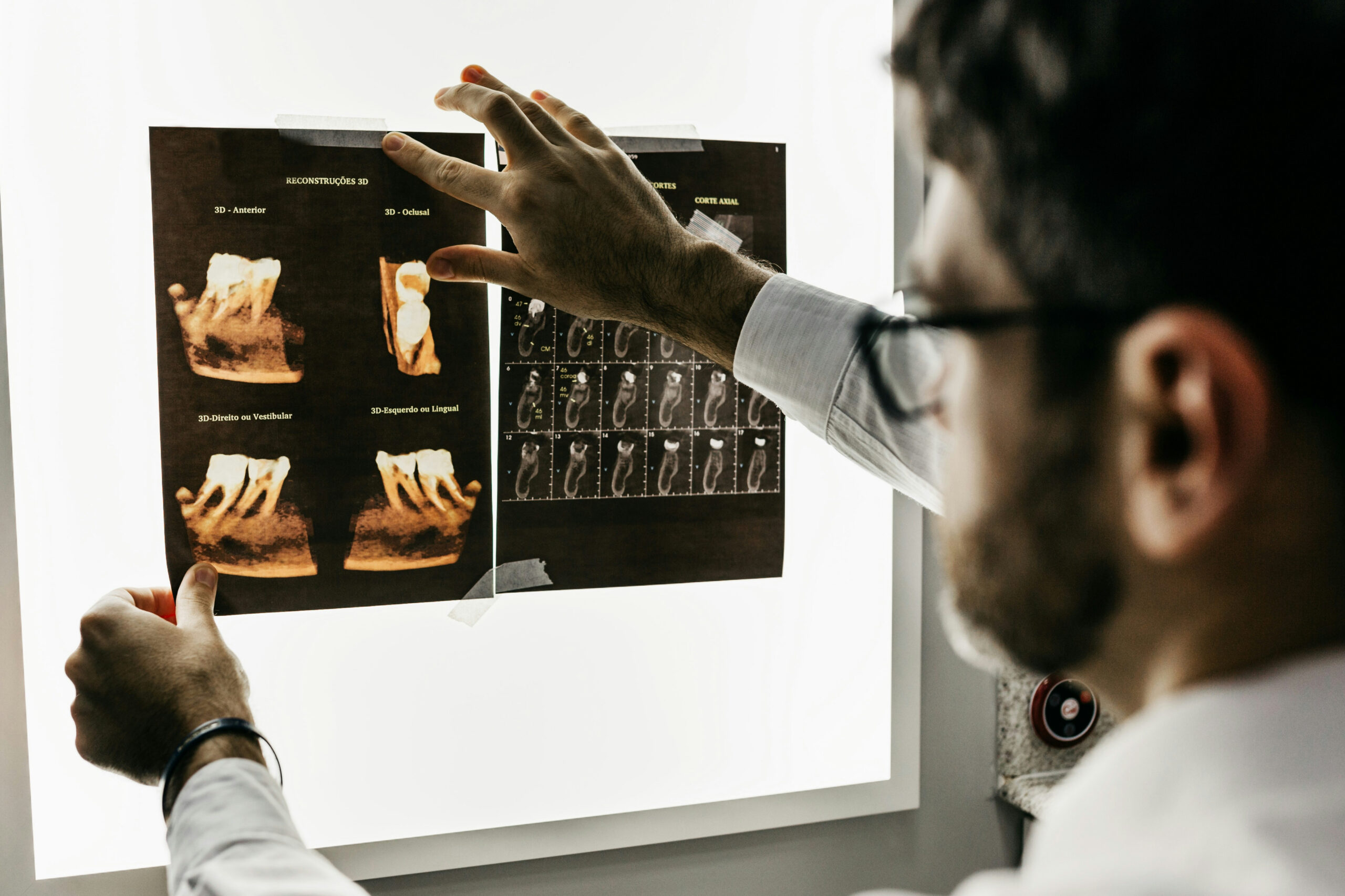 A person looking at an xray